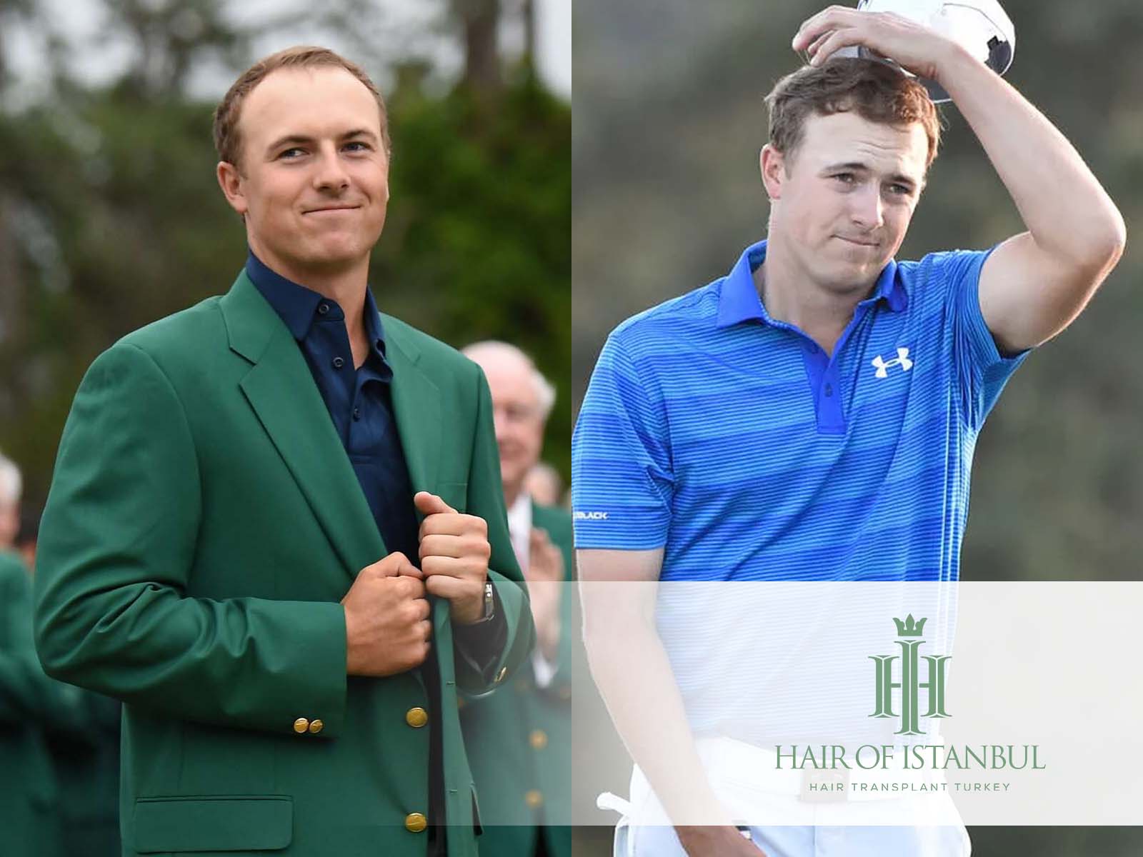 Jordan Spieth's Hair Transplant The Story Behind His New Look!