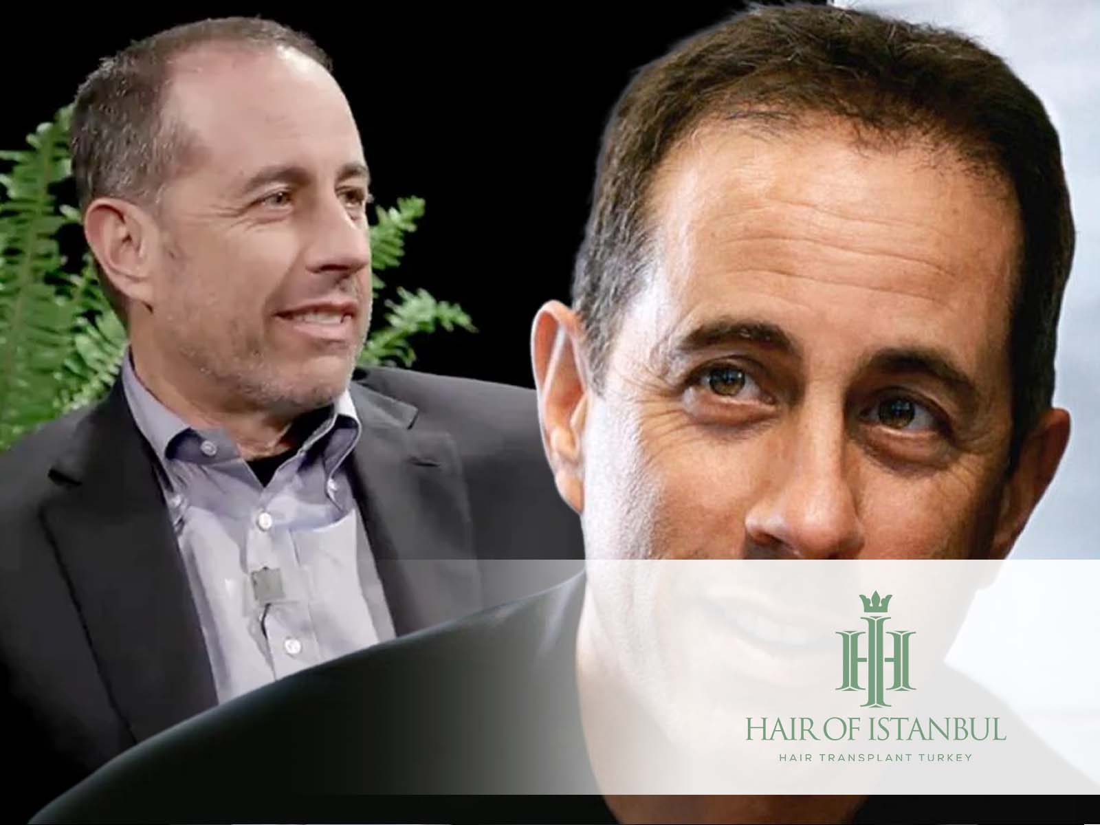 Jerry Seinfeld Hair Transplant: Comic's Hair Makeover True?