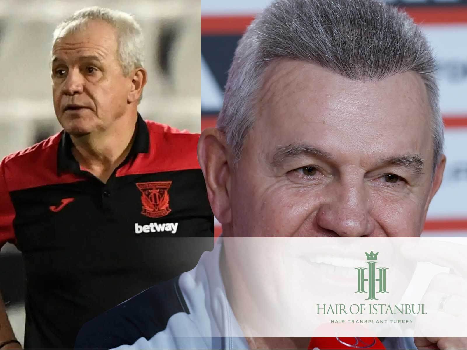 El injerto de pelo de Javier Aguirre