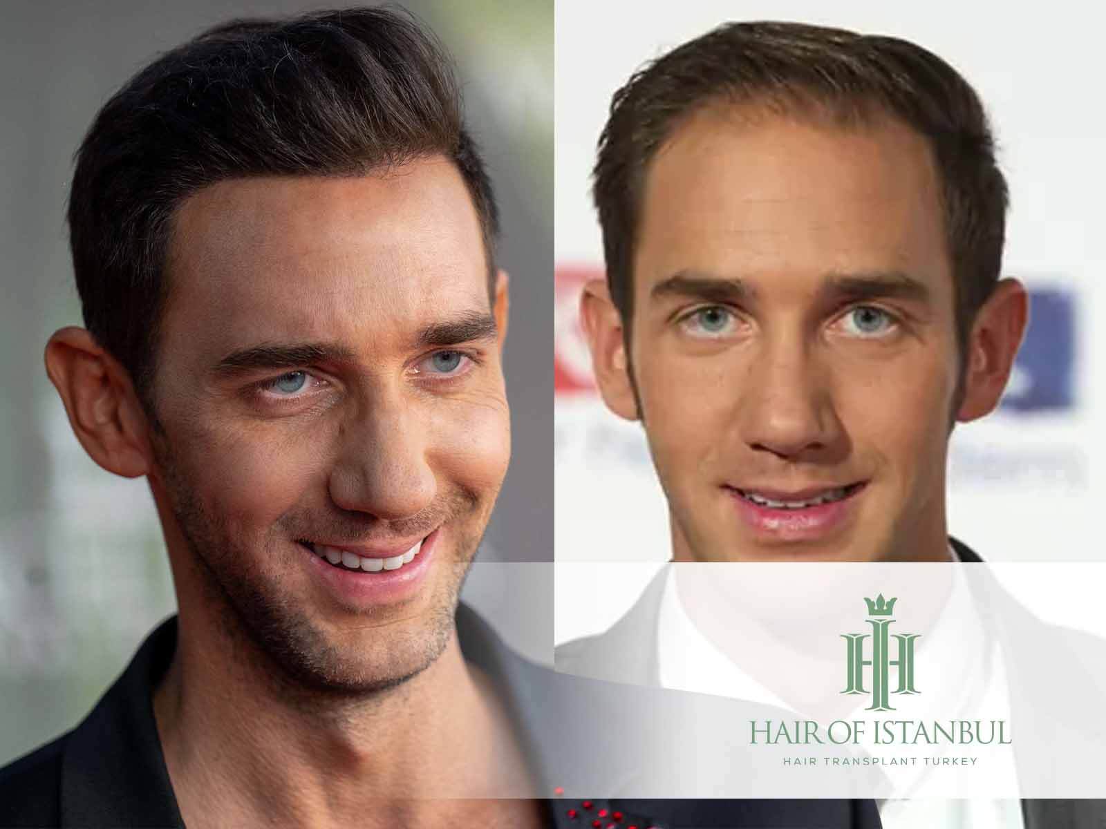 Marcel Remus Haare